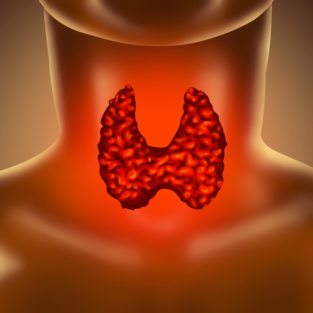 Illustration of Human Thyroid Gland-Thyroid Disorders